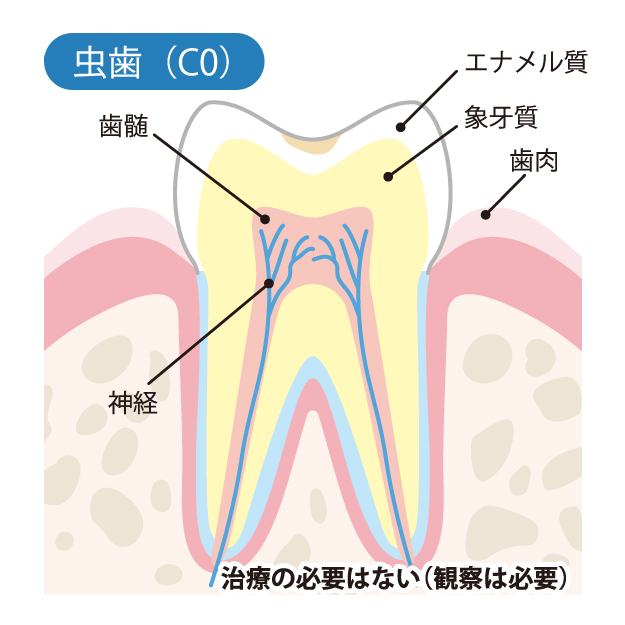 亀有の歯医者、西川クリニック歯科室｜矯正歯科のむし歯治療