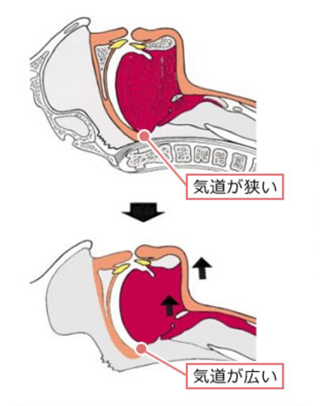亀有の歯医者、西川クリニック歯科室｜矯正歯科の睡眠時無呼吸症候群