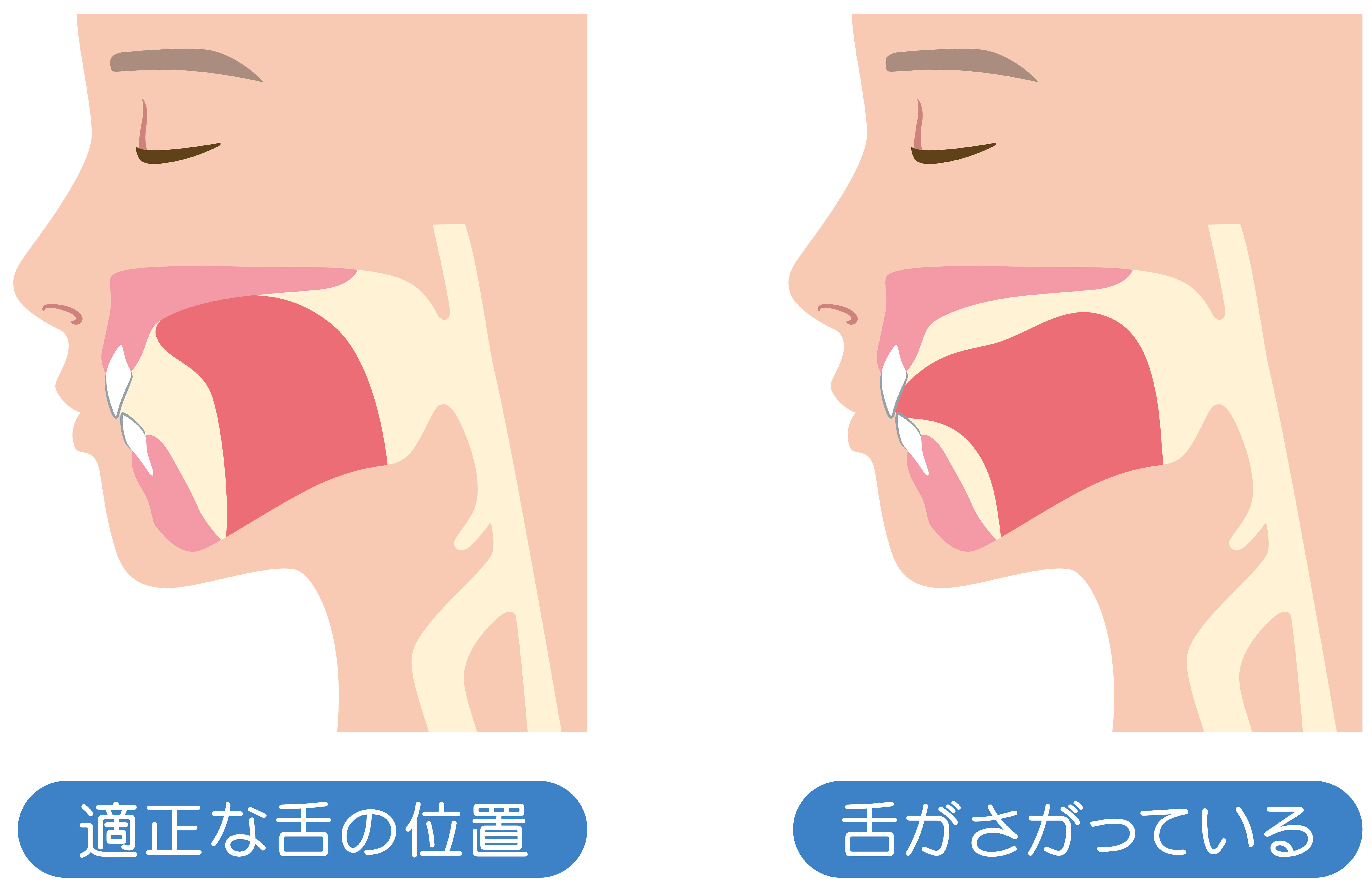 亀有の歯医者、西川クリニック歯科室｜矯正歯科のこどもの矯正歯科