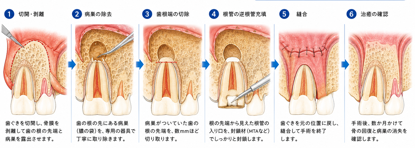 亀有の歯医者、西川クリニック歯科室｜矯正歯科の根管治療